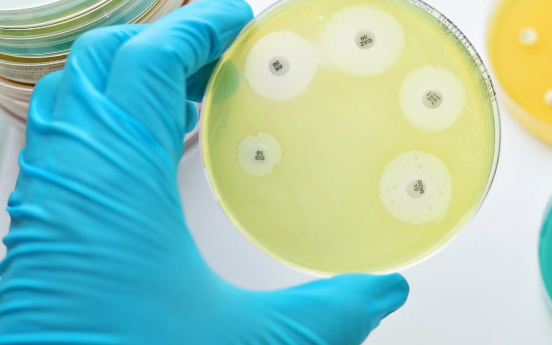 Análisis de genes resistencia a antibióticos en ‘E. Coli’