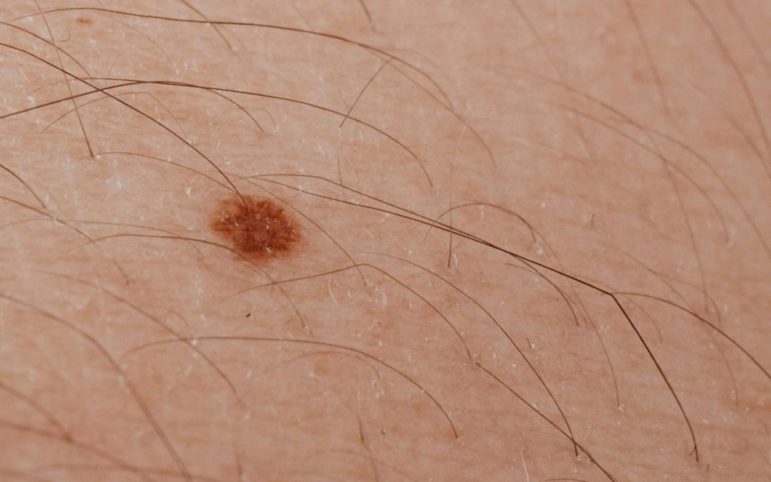 Panel Dermatología